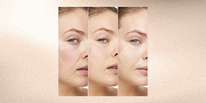 In Article Ruddy Skin Color Prime Lab Redness Eraser